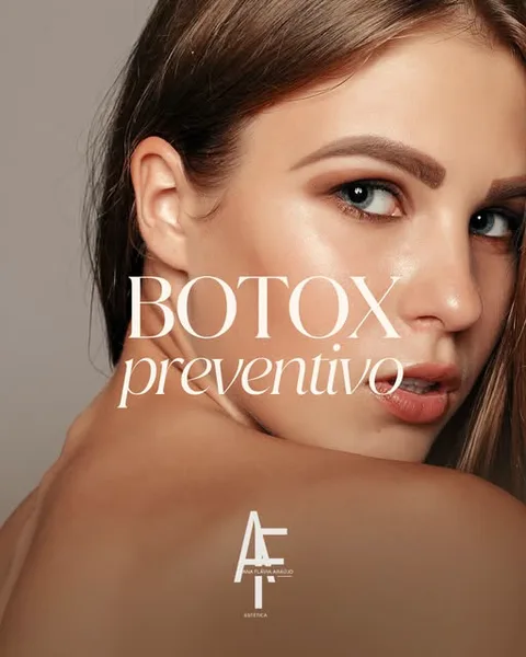 Post: botox preventivo